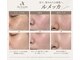 【たるみケア・シミケア・毛穴】エイジングケアAreum(アルム)戸塚の写真