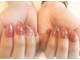 コロンネイル(Colon Nail)の写真