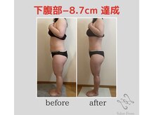 サロンフロム つくば店(Salon From)/◆セルゼロ上半身◆