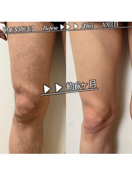 ブラックスワン(Black Swan)/