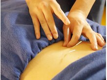 本厚木 リターナル(ReTurnal)/鍼/腰痛