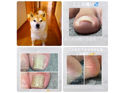シャドウ(shadow)の写真