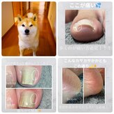 シャドウ(shadow)