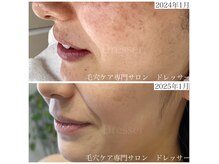 ドレッサー(Dresser)の雰囲気（30代後半からでも年齢関係は関係ないです）