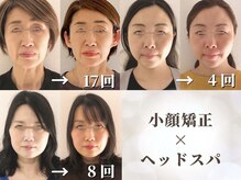まどろみ(madoromi)の雰囲気（人気の【小顔矯正】自然な顔全体リフトアップ＆小顔を叶えます。）
