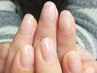 深爪矯正(ハンド)スカルプで長さ出し有り(クリア・カラーなし)