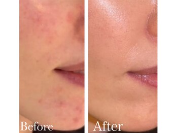 MMK/艶肌になりたい