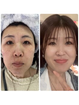 ラ ムーン アイラッシュアンドヘアメイク(La.Moon)/ルネセル化粧品ビフォーアフター