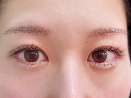 アーラ(ala)の写真