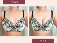 美人バスト リグラス(ReGrous)