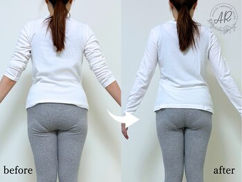 エーアール(AR)の写真/【ムダ肉、実は「歪んだ骨格」のせい】積もった浮き輪肉・年々たくましくなるヒップ・太ももをスッキリ！