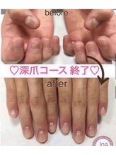 ネイリックス 栄ガスビル(NAILX)/深爪の方でも諦めないで！！