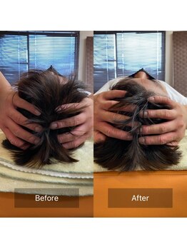 カラダプラス(kArAdA+)/頭蓋骨矯正ビフォーアフター