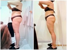 クイーン 札幌駅前店(Queen)/お客様　ビフォーアフター（19）