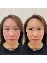 ラ クレール ビューティーサロン(LA CLAIR)/小顔リフトマシン豊富に取り揃え