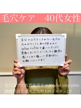 エクラ アン(eclat.un)/毛穴スペシャル　30代:女性