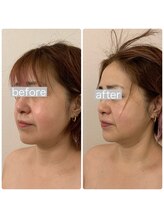 ラヴィエ ベル(La vie est belle)/ゼロコルギ本コースで小顔に！！