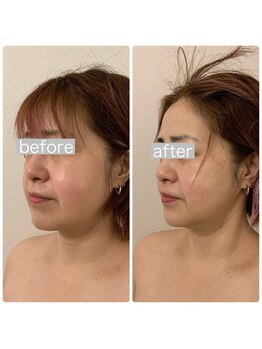 ラヴィエ ベル(La vie est belle)/ゼロコルギ本コースで小顔に!!