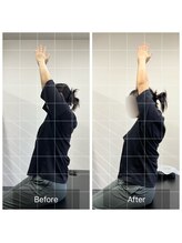 ナオル整体 大塚院(NAORU整体)/20代女性施術事例【猫背矯正】