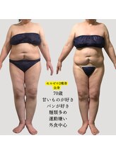 ミテ(Mite)/運動なし♪食生活改善＋痩身
