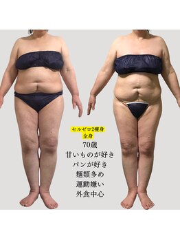 ミテ(Mite)/運動なし♪食生活改善＋痩身