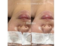 ルチルス(Rutiles)の雰囲気（くすみ角質除去/透明感/エイジングケア◎大満足の新メニュー追加）