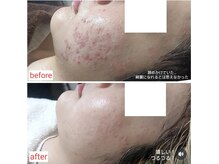 ミュー(Mieux)の雰囲気（肌悩みはもう終わりにしませんか？あなたも綺麗になれますよ！）