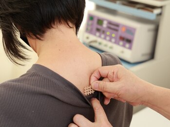 渡辺接骨院の写真/妊婦さん・産後ママへ！非接触の検査とテープで腰の不調を優しくケアします◎