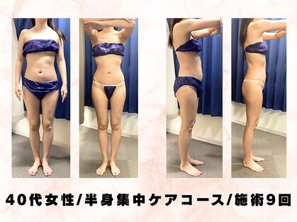 パラディ(PARADIS)の写真