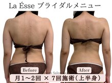 ラエッセ(La Esse)/背中美人は作れます！