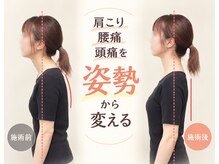 プレーバ(Preava)