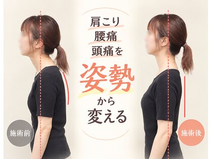 プレーバ(Preava)の写真