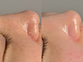 ルーナジェーナ(Luna llena)/池袋 エステ ルーナジェーナ