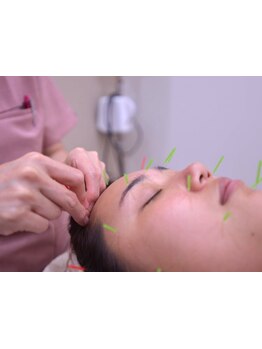 眼精疲労を解消したい