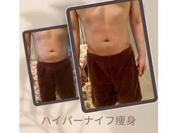 トータルエステサロン エステアンドメイク 錦糸町/錦糸町 メンズ痩身