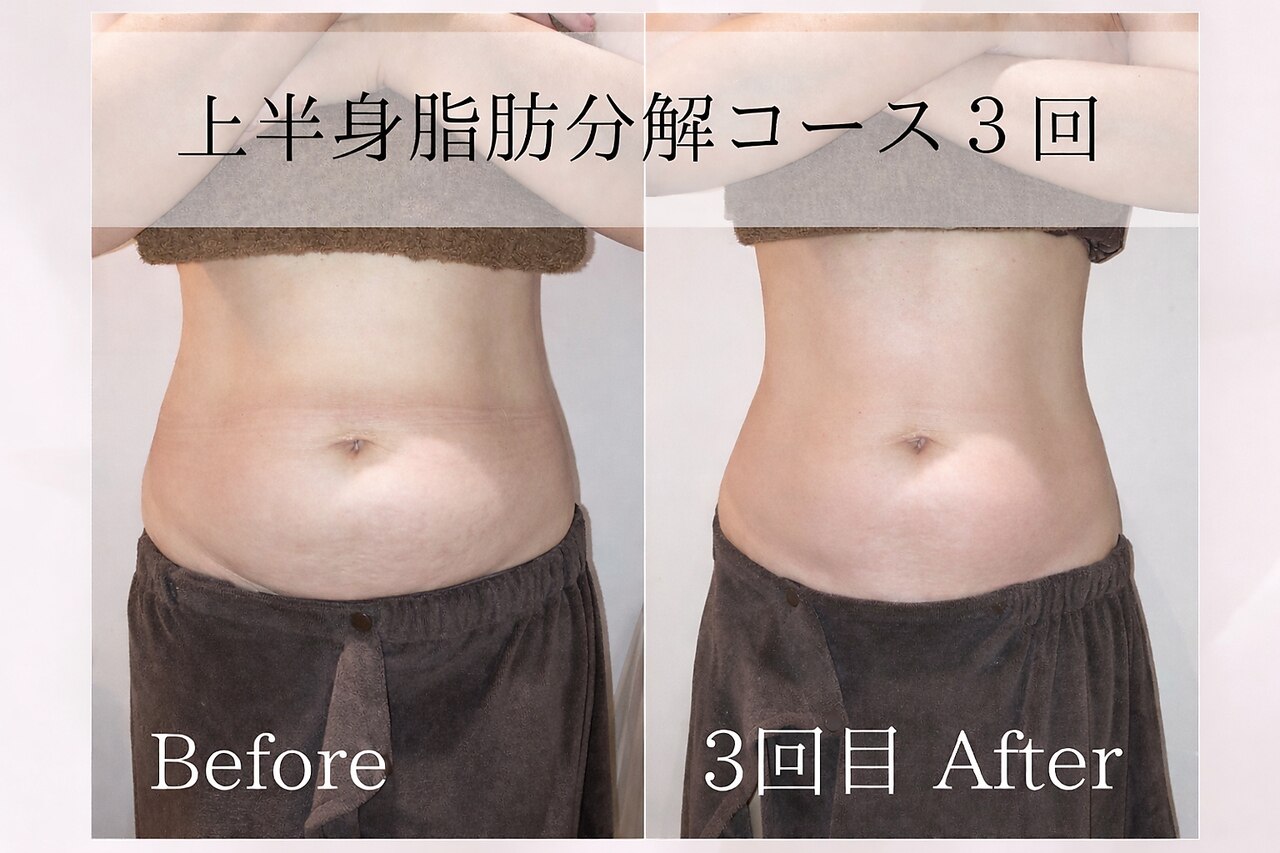 ミア(miiia)｜ホットペッパービューティー