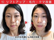 那賀洋子式 顔ジム 大分戸次店/40代女性顔ジム継続の効果