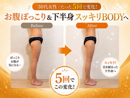 ヨサパーク モカ(YOSA PARK Moca)の写真