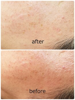 ハクミー(haku me)/☆次世代リバイブハーブ☆