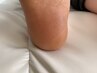 【かかと＆足裏全体ケア◎】角質ケア＋フットマッサージ80分¥10,800