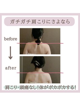 ミトラ(MITRA)/40からのこり/冷え/疲れ解消！