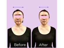 ビーホリック(Bholic)/