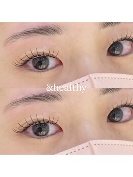 ネオリーブ ウリ(Neolive uri)/アンドヘルシー