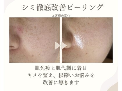 ジャスミン(Jasmine)の写真