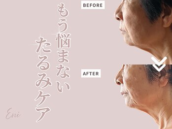 エニ(Eni)/1回で変化を実感したい方へ