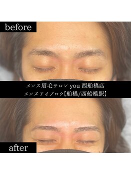 ユー 西船橋店(you)/ビフォーアフター写真