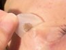 【塗るだけで取れる！痛み緩和シミケア☆】1cm×1cm  アフタークリーム付き☆