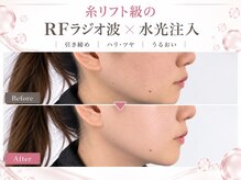 アイムエステ 千葉富士見本通り店(i'm este)の雰囲気（10種類の最新高性能フェイシャルマシンをどこよりもお得に◎）