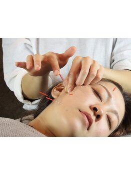 鍼灸施術を受けたい