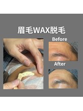 イデアル(ideal)/眉毛WAX脱毛